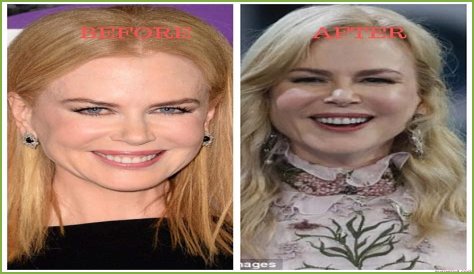 Nicole Kidman's 